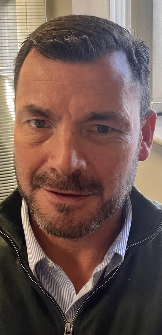 Wimpole hair restoration after