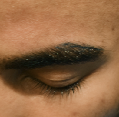 Eyebrow transplant before 2