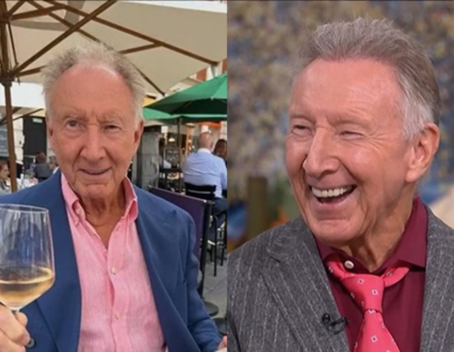 Wimpole hair restoration before and after results
