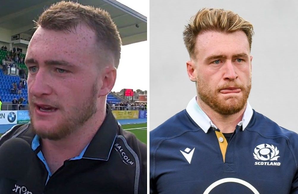 Before and after Stuart Hogg's hair transplant