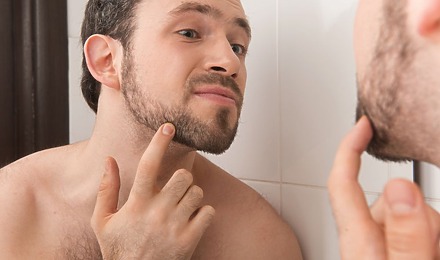 Causes Of Beard Hair Loss