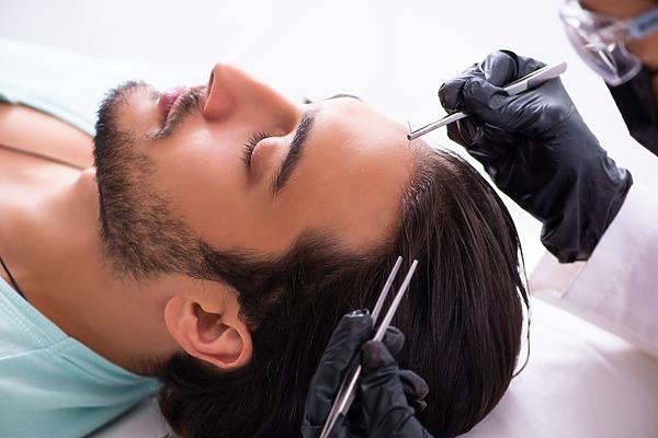 hair plugs vs hair transplant