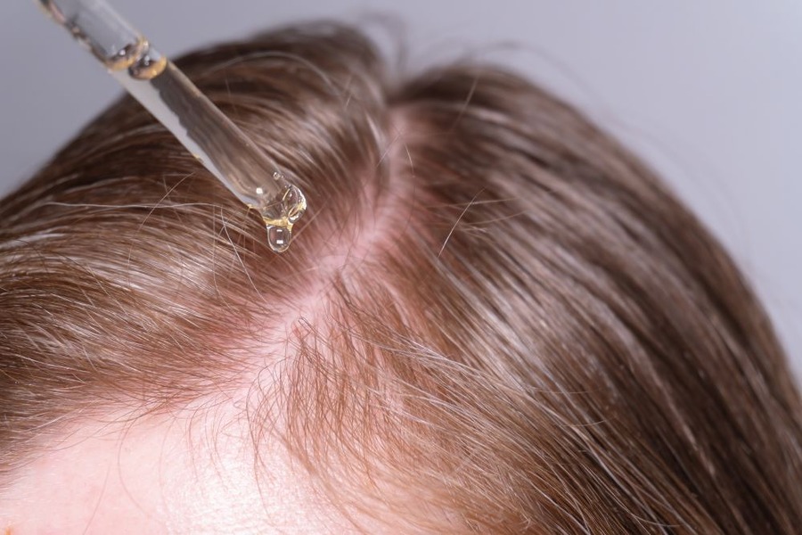 Stemoxydine For Hair Loss