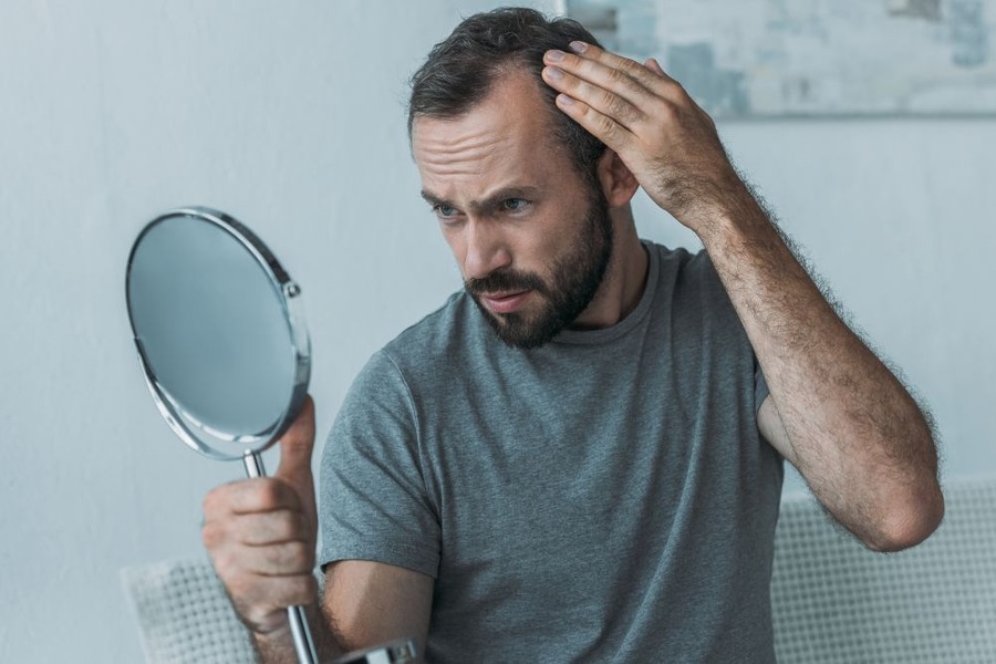 Hair Loss Symptoms