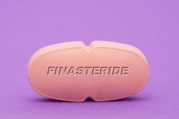 Finasteride Guide