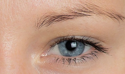 Does Minoxidil Work Eyebrows