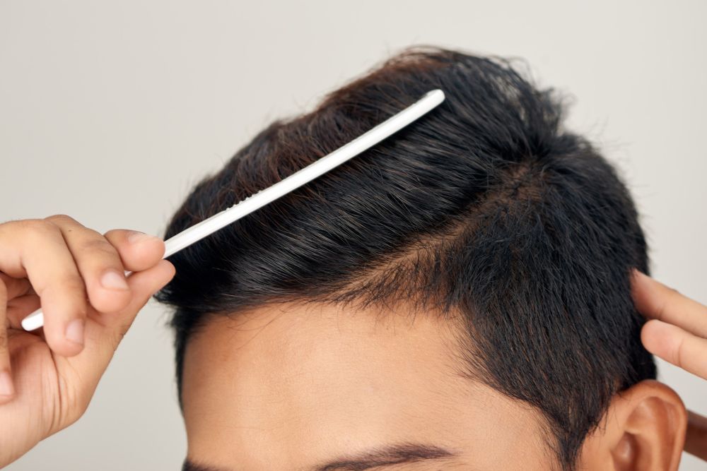 Can A Hair Transplant Increase Hair Density?