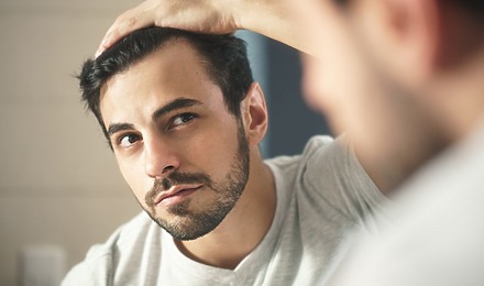 Second Hair Transplant