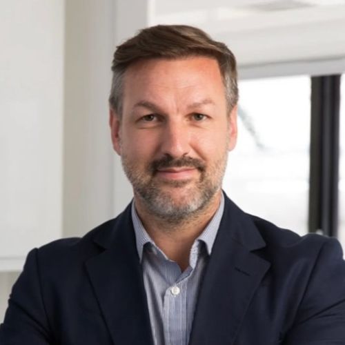 Results of James Walton&rsquo;s hair transplant at the Wimpole Clinic