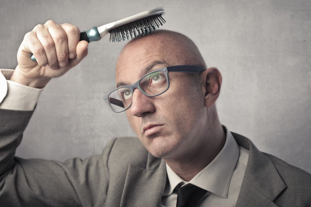 Can You Get A Hair Transplant If You Are Completely Bald?