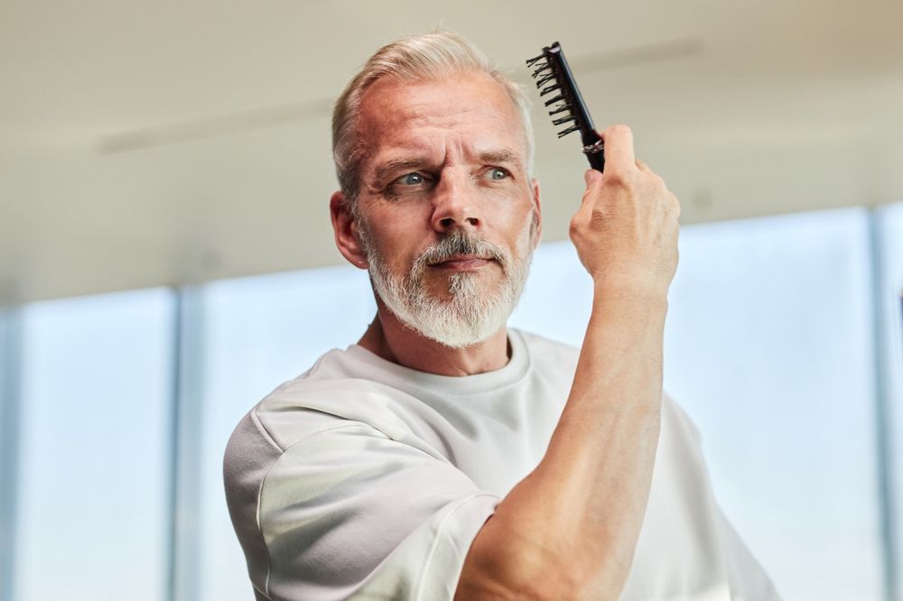 Hair Transplant After 3 Months: Photos, Results, Side Effects