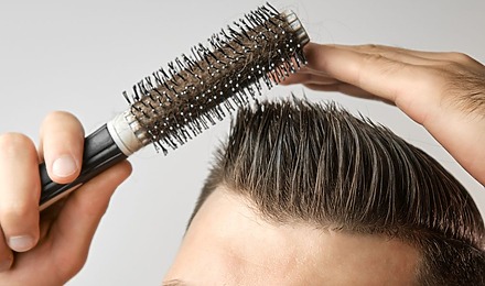 Hair Transplant After 6 Months