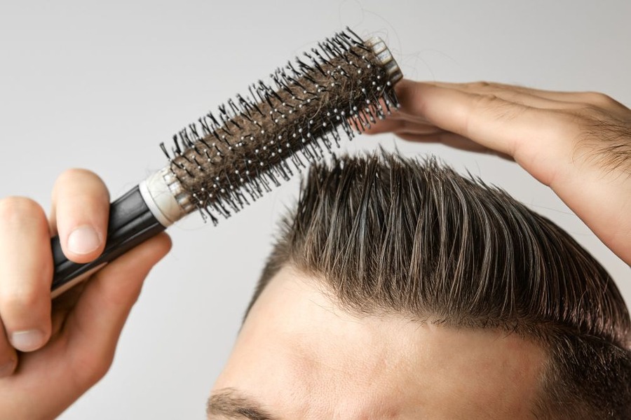 Hair Transplant After 6 Months