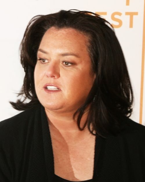 Rosie O&rsquo;Donnell&rsquo;s hairline