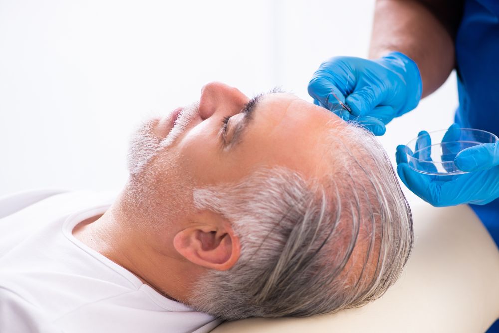 Hair Transplant Death Rate: Should You Be Worried?