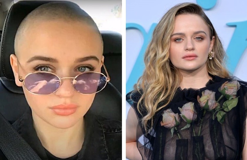 29-bold-bald-women-who-rocked-a-shaved-head-wimpole-clinic