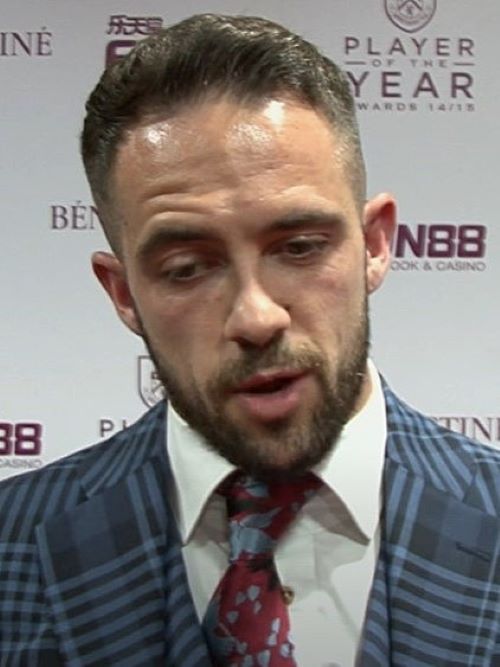 Danny Ings&rsquo; pre-hair transplant uneven hairline