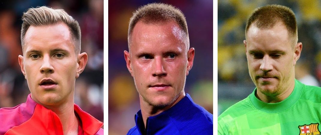 Marc-Andre Ter stegen&rsquo;s worsening hair loss