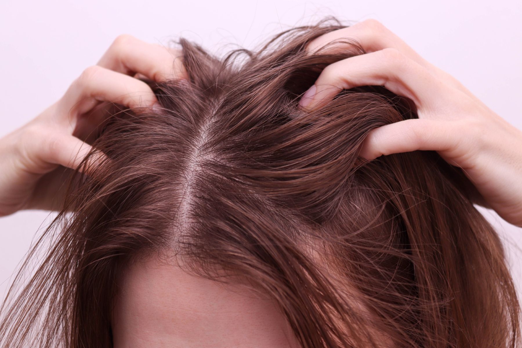 itchy scalp