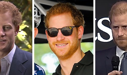 Prince Harry&rsquo;s Hair Transplant - Everything You Need To Know