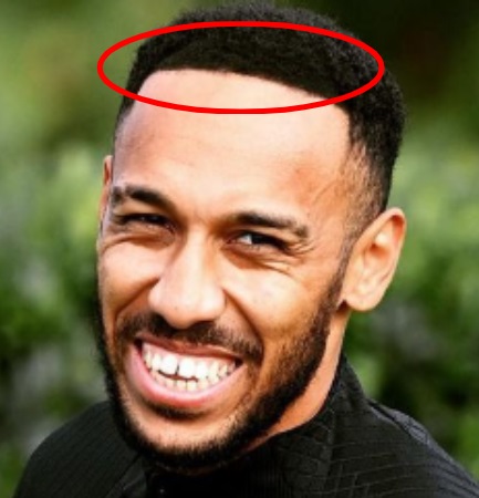 Auba&rsquo;s new hairline looking suspicious
