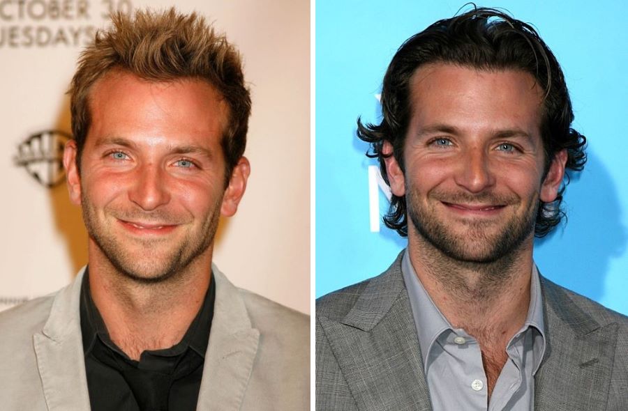 Bradley Cooper&rsquo;s hairline changed between 2007 and 2008