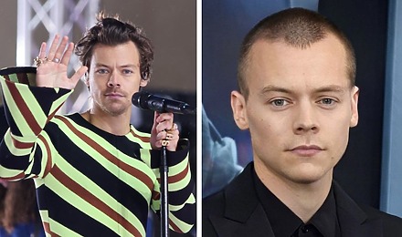 Is Harry Styles Balding? The Scoop On Harry&rsquo;s Hair Journey