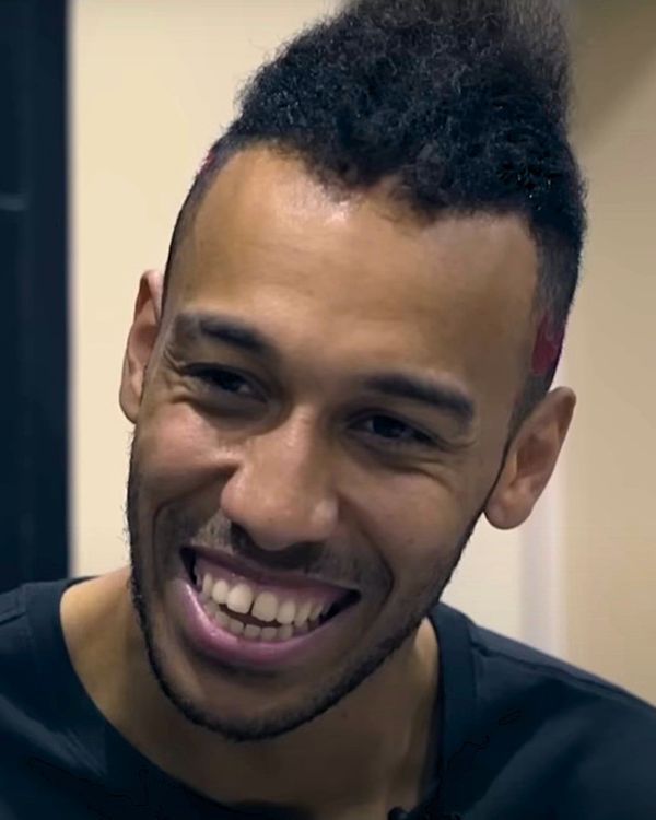 Auba&rsquo;s hair visibly thinning in 2017