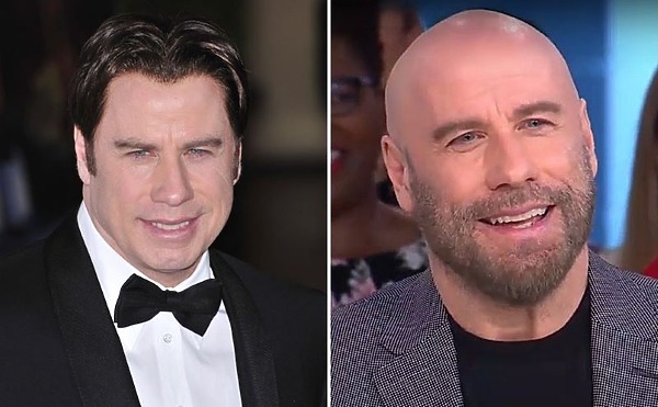 John Travolta&rsquo;s Hair Transplant: Toupee or not Toupee?