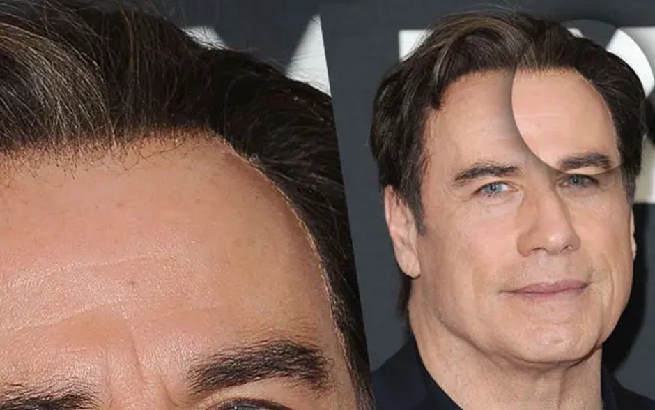 Travolta&rsquo;s toupee adhesive showing