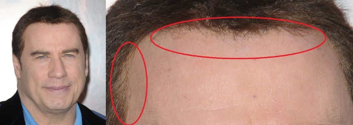 Travolta&rsquo;s toupee edges visible in photo