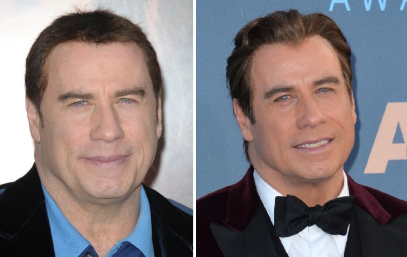 Travolta&rsquo;s wig-wearing years