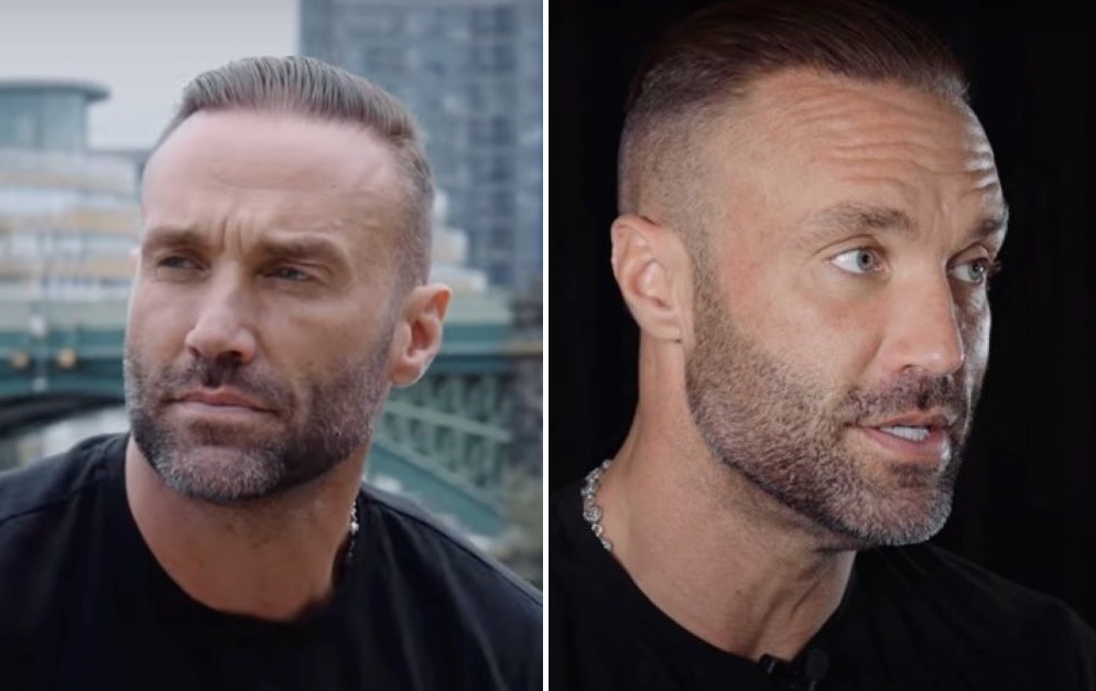 Calum Best&rsquo;s hair in 2024