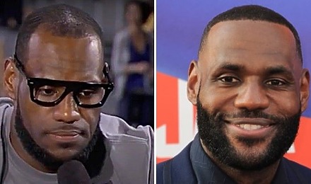 LeBron James&rsquo; Hairline: Did LeBron James Have A Hair Transplant?