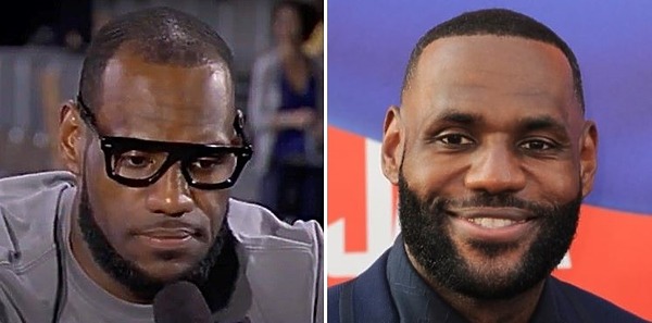 LeBron James&rsquo; Hairline: Did LeBron James Have a Hair Transplant?