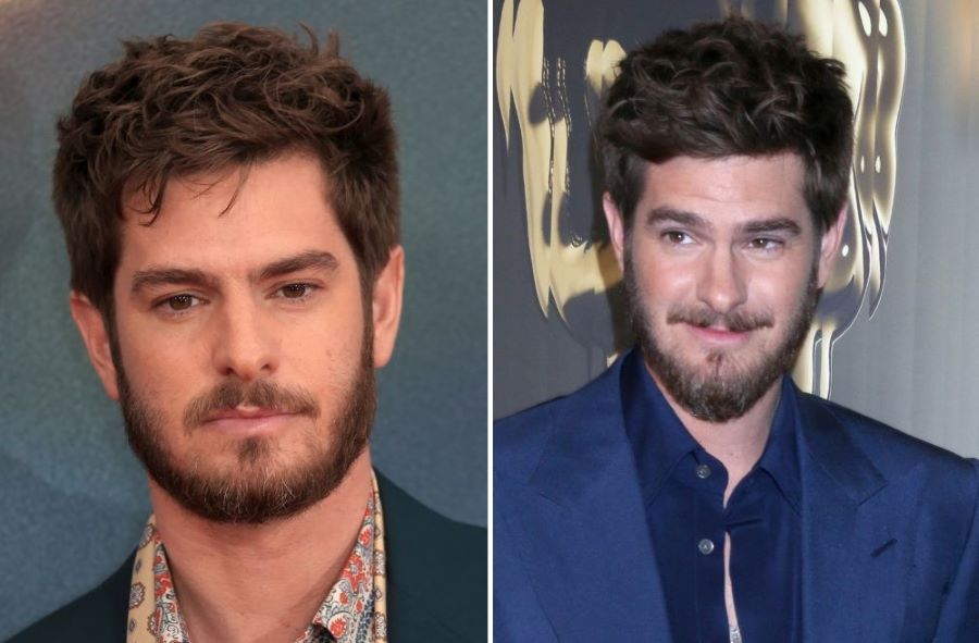 Andrew Garfield&rsquo;s 2024 hairline
