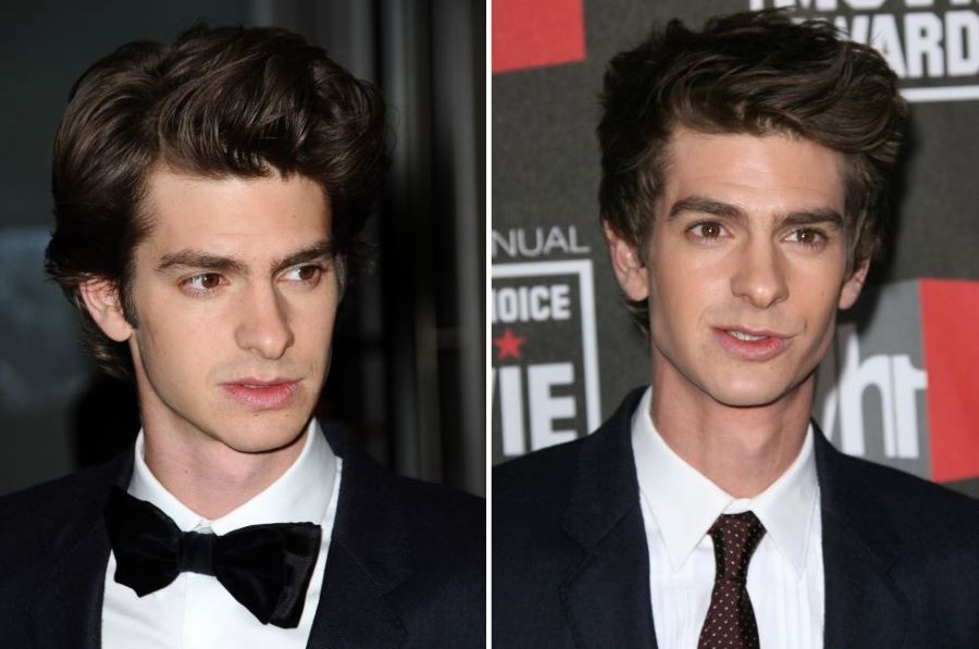 Andrew Garfield&rsquo;s hairline 2010-2011
