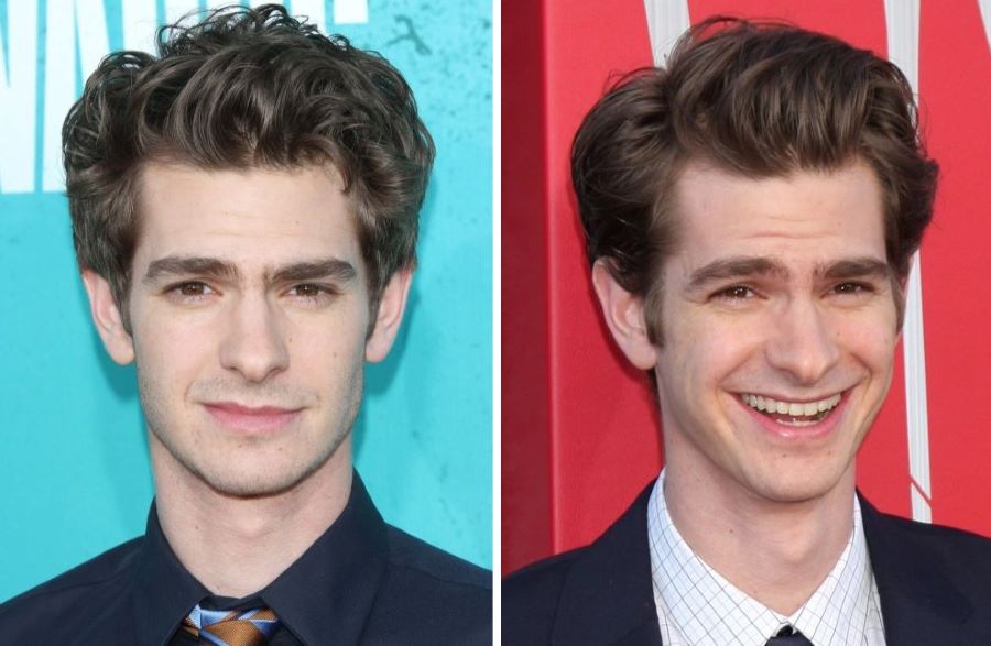 Andrew Garfield&rsquo;s hairline 2012