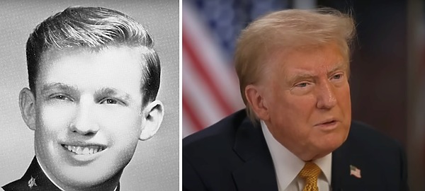 Donald Trump&rsquo;s Hair: Did He Have a Hair Transplant?