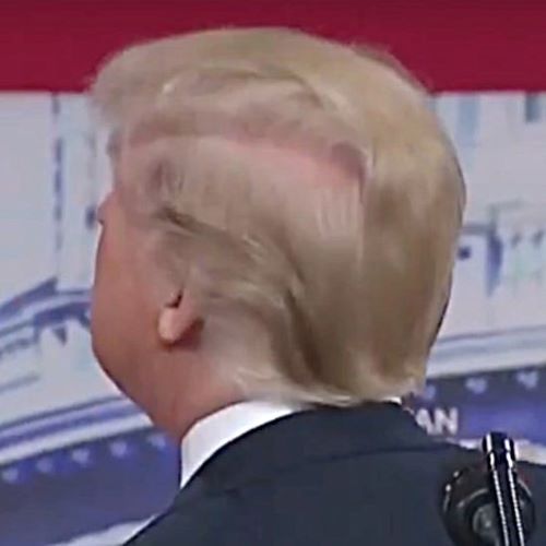 Trump&rsquo;s bald spot