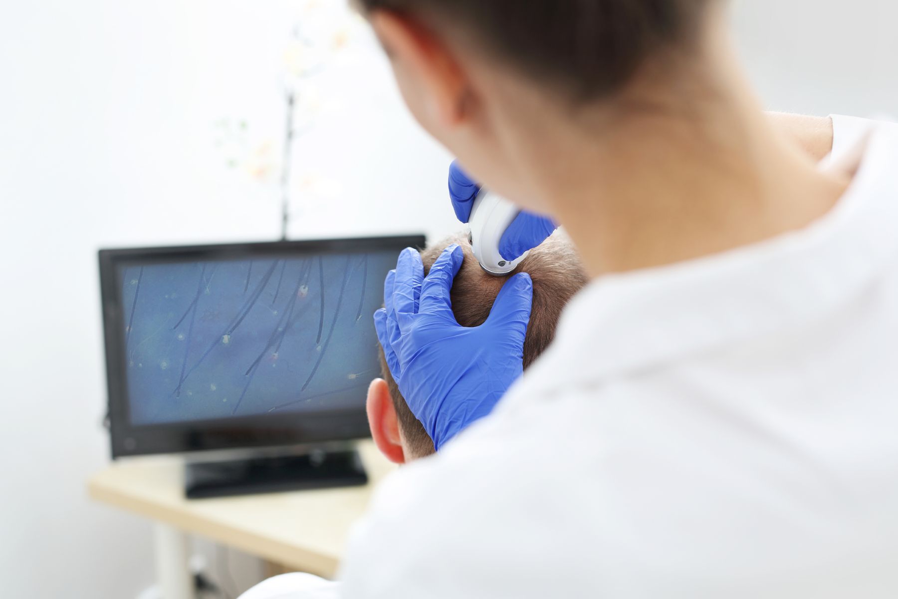 Doctor examining patient&rsquo;s scalp