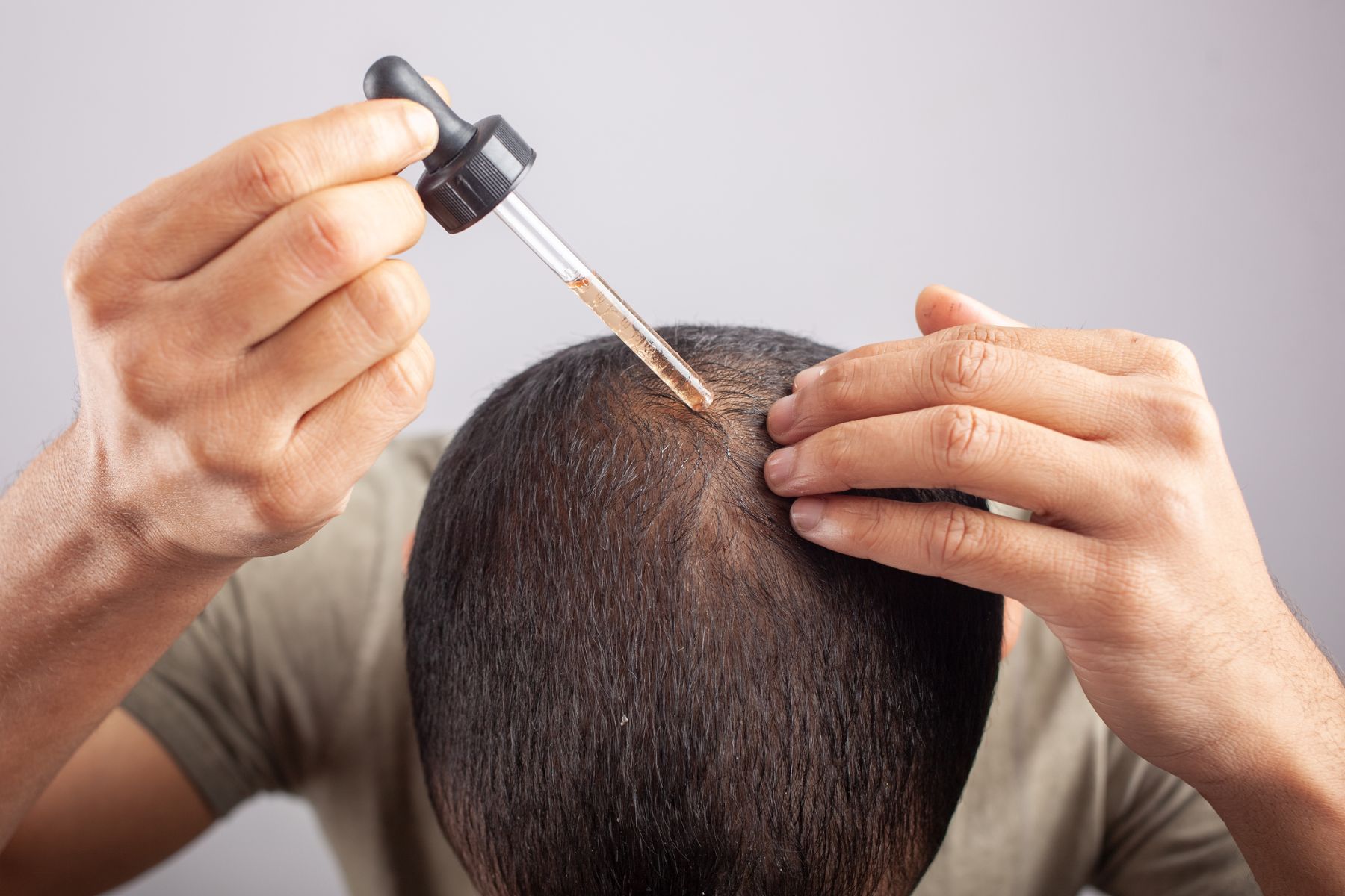 Man using hair growth treatment