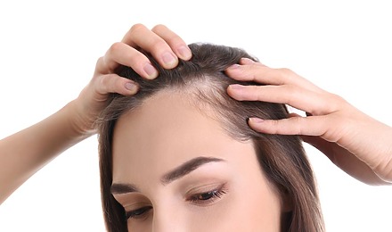 Temporal Triangular Alopecia: Causes, Symptoms And Treatment