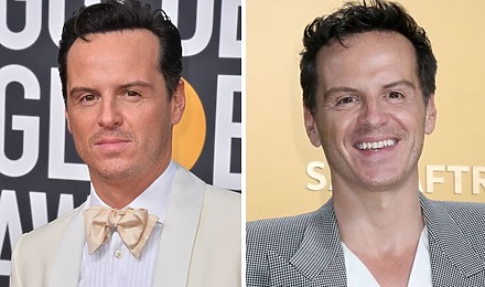 Andrew Scott&rsquo;s Hair Transplant - Did It Really Happen
