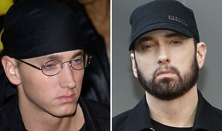 Eminem Beard Transplant
