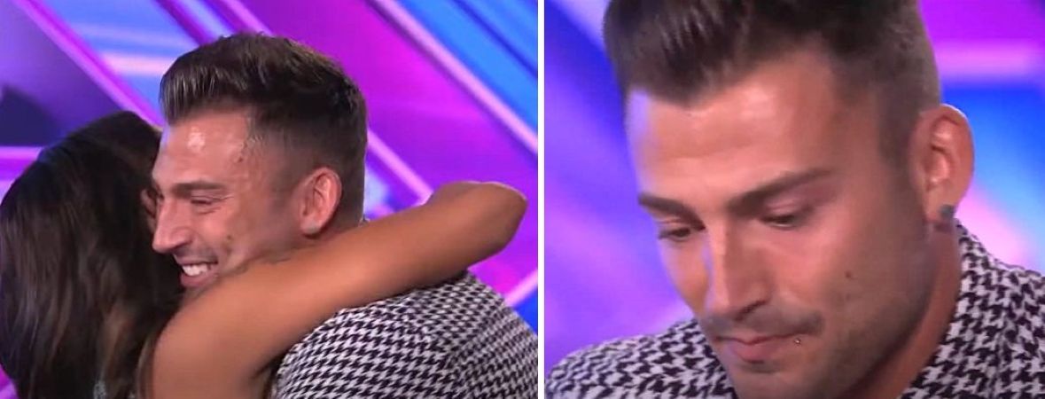 Jake Quickenden&rsquo;s temple hair loss and m-shaped hairline