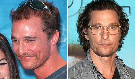 Matthew McConaughey&rsquo;s Hair Transplant: Why The Rumour Started