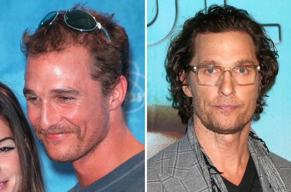 Matthew McConaughey&rsquo;s Hair Transplant: Why The Rumour Started