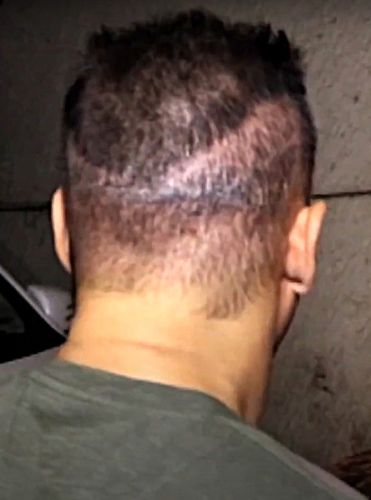 Salman Khan&rsquo;s FUT scar