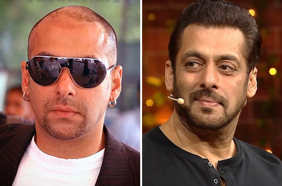 Salman Khan hair transplant